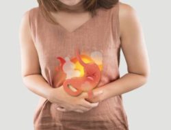 Tips Turunkan Asam Lambung Dengan Cara Tradisional