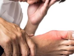 Kenali Penyakit Asam Urat, Serta Lakukan Pencegahannya